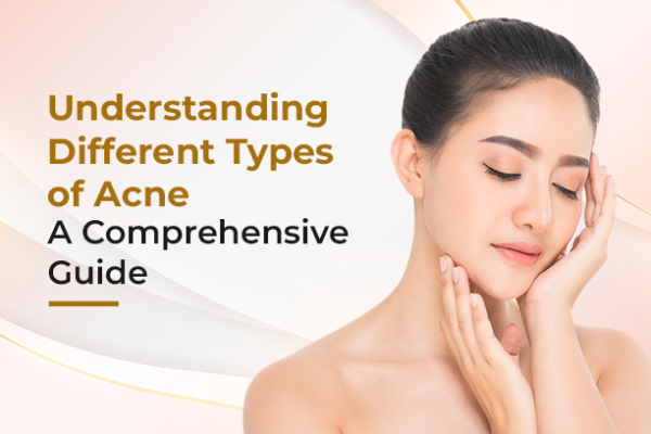 understanding diiferen types of acne