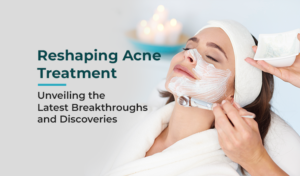 Acne Therapy