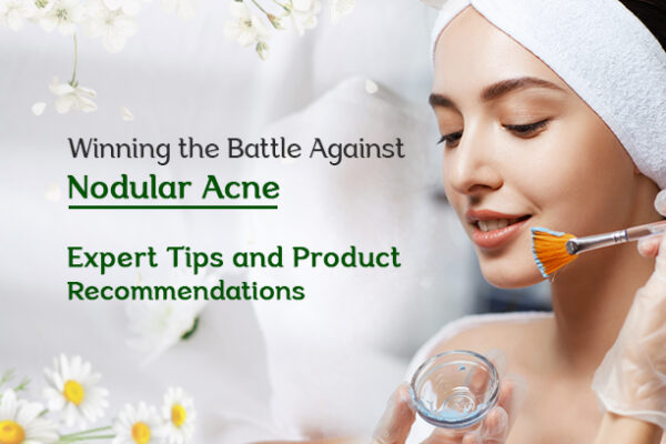 expert tips for treating Nodular acne