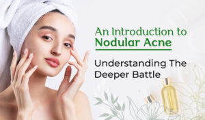 Nodular Acne1