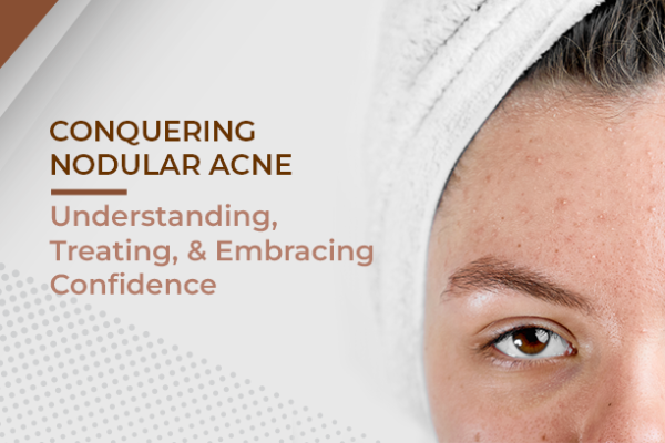 nodular acne treatment