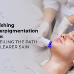 hyperpigmentation