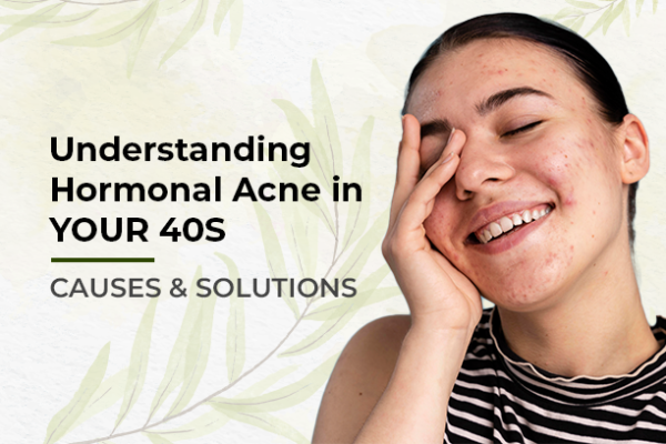 understanding hormonal acne