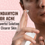 Clindamycin for Acne