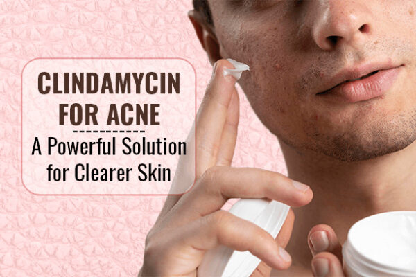 Clindamycin for Acne