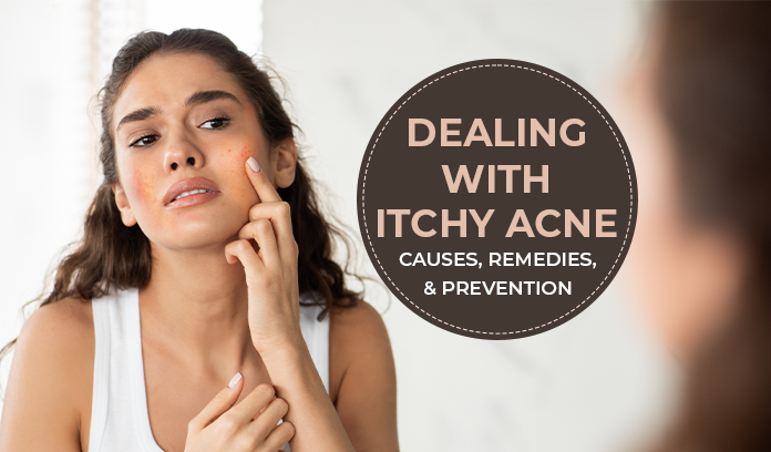 Dealing with Itchy Acne