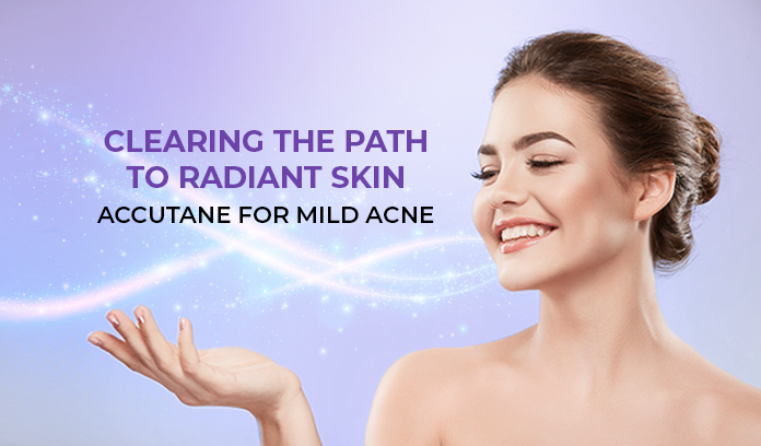 Accutane for mild Acne