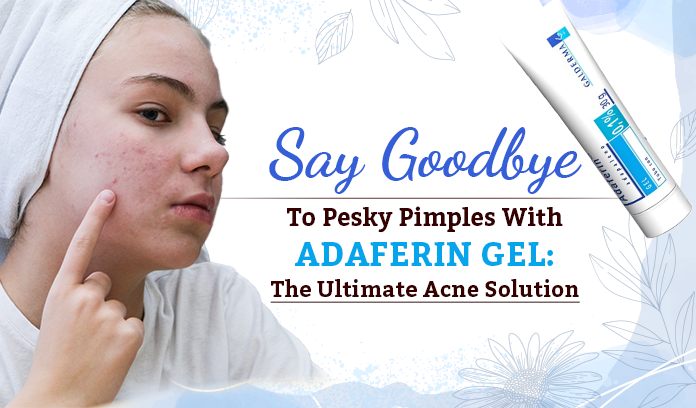 Adaferin Gel for acne
