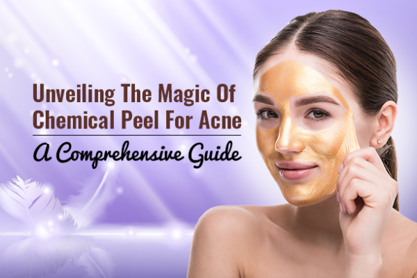 Chemical Peel For Acne