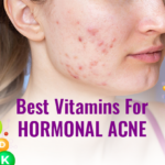 best vitamins for hormonal acne