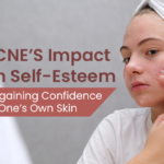 Acne and Self-Esteem