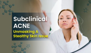 subclinical acne