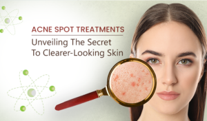 Acne Spot Treatments