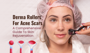 Dermarollers For Acne Scars