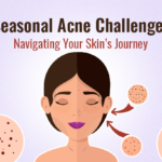 Seasonal Acne Challenges
