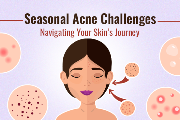 Seasonal Acne Challenges