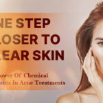 Chemical Exfoliants