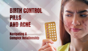 Birth Control Pills And Acne
