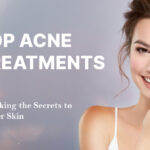 top acne treatments