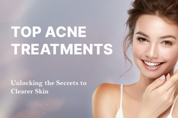 top acne treatments
