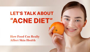 foods that cause acne