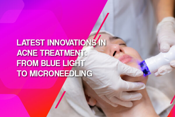 Latest Innovations in Acne Treatment: From Blue Light to Microneedling